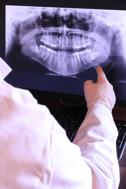 Best Emergency Treatment for Dental Infections or Abscesses in Centre Grove, NJ